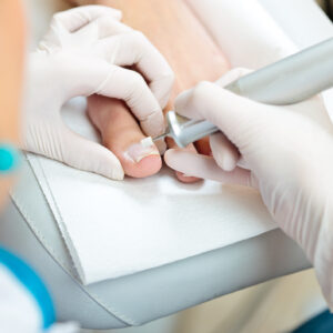A chiropodist taking care of woman's foot - polishing nails with a special tool